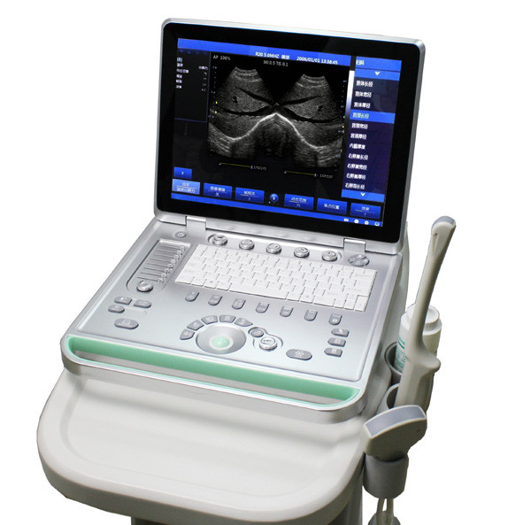 Wholesale SS-8 Laptop Ultrasound B scanner(ARM based) home ultrasound machines handheld ultrasound from china suppliers