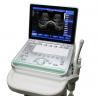 Buy cheap SS-8 Laptop Ultrasound B scanner(ARM based) home ultrasound machines handheld from wholesalers