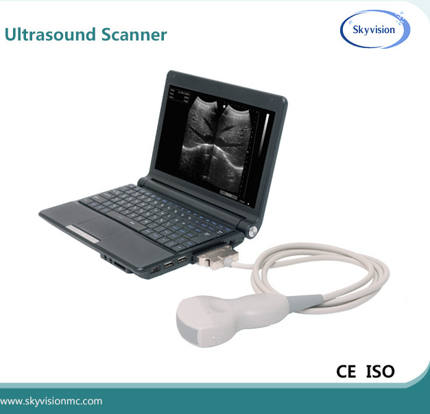 Wholesale digital laptop black&white image ultrasound machine from china suppliers