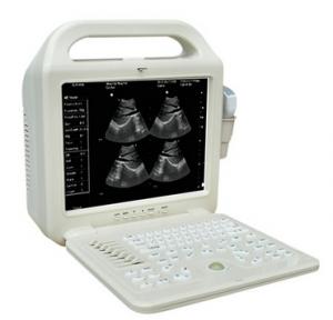 Wholesale 12 inch LCD monitor Medical Portable Ultrasound Scanner,Laptop B/W Ultrasound Scanner from china suppliers