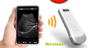 Wholesale portable wireless ultrasound scanner machine device convex probe transducers from china suppliers