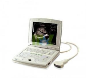 Wholesale Laptop Full Digital Ultrasound Scanner for sale-MSLDU07 from china suppliers