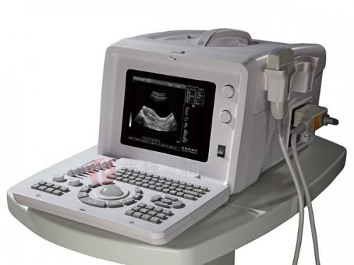 Wholesale 3.5MHz R60 - Frame Portable Ultrasound Scanner With Video Output from china suppliers