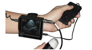 Wholesale Veterinary Ultrasound Scanner V2 Veterinary Wrist ultra sound machine for pet animal from china suppliers