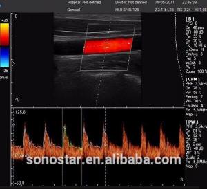 Wholesale Abundant functions cheapest portable 4D Color Doppler Ultrasound System with 12 inch touch screen from china suppliers