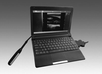 Wholesale 10.1 " TFT LCD Equine Veterinary Ultrasound Scanner Animal Ultrasonic Equipment from china suppliers