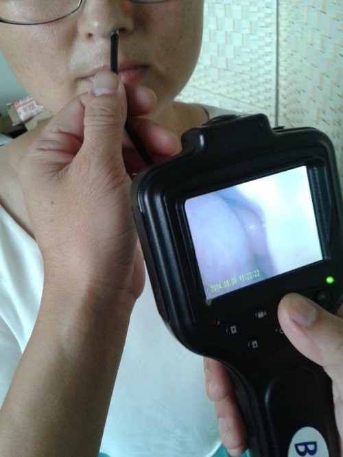Wholesale 2.8'' TFT Color LCD Digital Otoscope , Rhinoscope Resolution 2560 X 1920 from china suppliers
