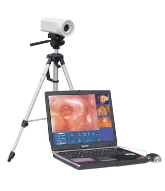 Wholesale Microscope Colposcope from china suppliers