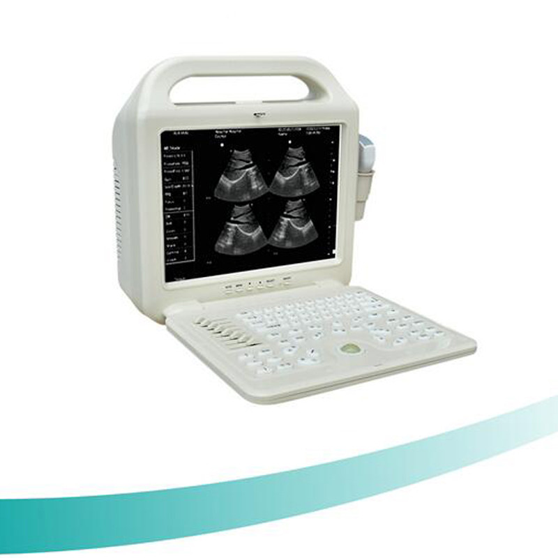 12 inch LCD monitor Medical Portable Ultrasound Scanner,Laptop B/W Ultrasound