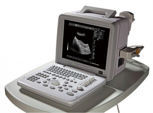 Wholesale 8 Segments TGC Notebook B / W Portable Ultrasound Scanner WithProbe ’ s Position from china suppliers
