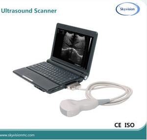 cheap portable 10''LCD monitor B/W Ultrasound Scanner for abdomen, gynecology,