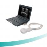 cheap portable 10''LCD monitor B/W Ultrasound Scanner for abdomen, gynecology,