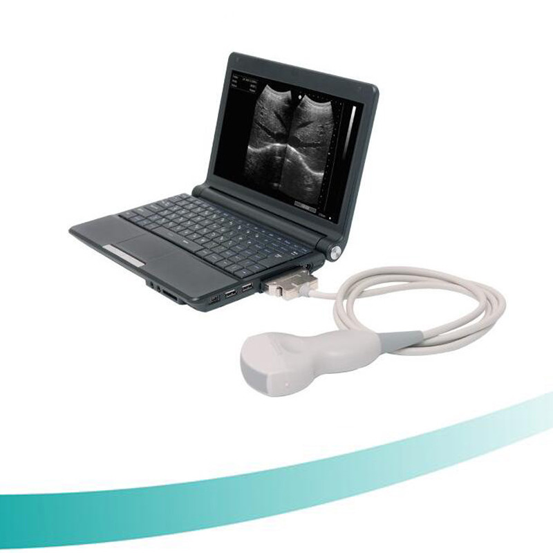 Wholesale cheap portable 10''LCD monitor B/W Ultrasound Scanner for abdomen, gynecology, obstetrics, urology, breast, etc. from china suppliers