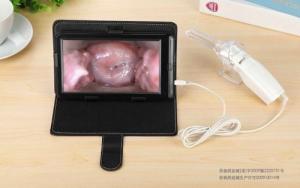 Wholesale High Definition Display AV / USB Output Vaginal Probe Digital Electronic Colposcope from china suppliers