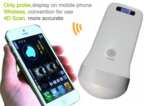 Wholesale Iphone Ipad smartphone 4D Wireless Probe Bladder Ultrasound Scanner from china suppliers