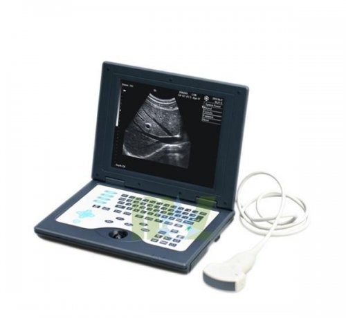 Wholesale Best portable laptop ultrasound scanner with CE certificate MSLPU23 from china suppliers