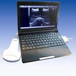 Wholesale 10.1" TFT LCD Ultrasound Scanner with Convex Linear Transvaginal Micro Convex Probe from china suppliers