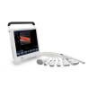 Buy cheap CE approved gynecology cardiac pregnancy Digital laptop Color scanner Doppler from wholesalers