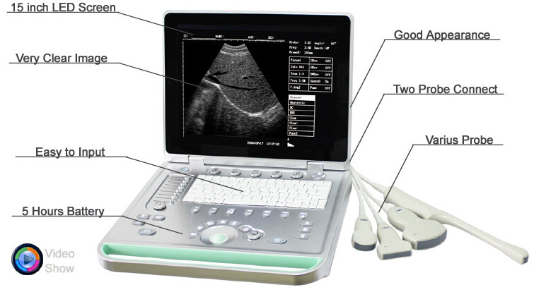 Wholesale Sonostar portable Veterinary Diagnostic Ultrasound V7 Laptop Ultrasound Scanne from china suppliers