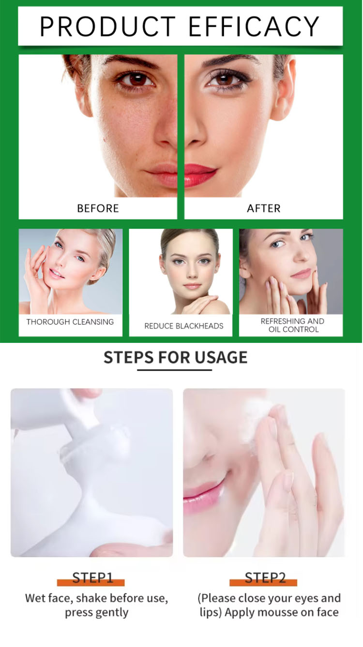 Turmeric Kojic Acid Mousse Clean Clear Skin Niacinamide Brightening Foaming Face Wash Cleanser for Dark Spots Skin