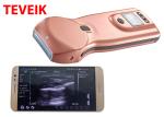 Color Doppler Wireless Ultrasound Probe Wifi ultrasound for Iphone / Android /
