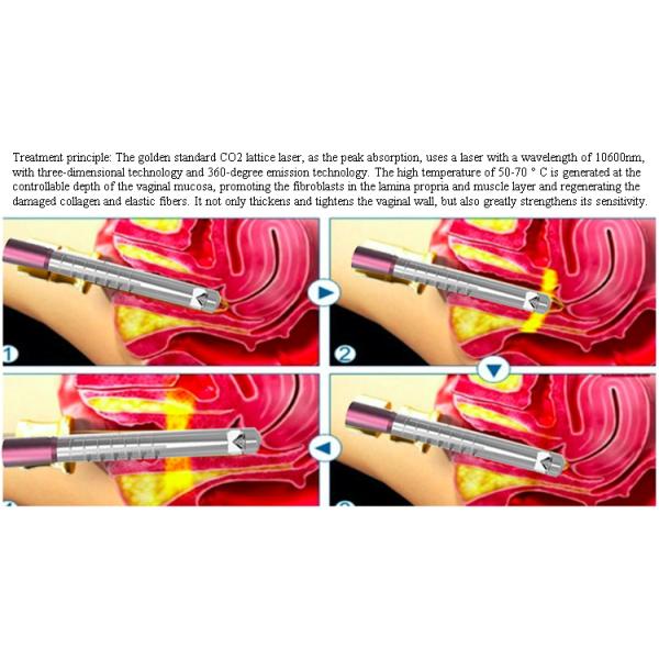 Fractional Co2 Laser Skin Rejuvenation Machine For Skin Wrinkle Removal Private Treat Acne Stretch Mark