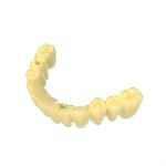 Temporary Crown And Bridge Resin DLP Printer Dental 3d Resin