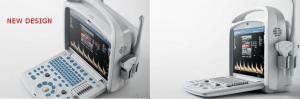 Wholesale Full Digital Portable Color Ultrasound Scanner Economical Color Ultrasound Doppler With PW Function from china suppliers