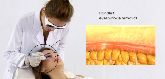 Touchscreen 5 In 1 vacuum cavitation Machine For Stretch Marks