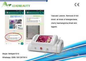 Wholesale 30MHZ High frequency Portable RBS Spider Vein Removal Machine for Clinic from china suppliers