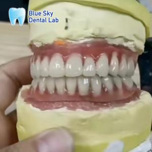Wholesale Full Upper And Lower Titanium Bar Blue Sky Dental Implants from china suppliers