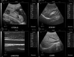Ultrasound Color Doppler Diagnostic Ultrasound Equipment Download Software From