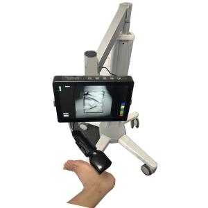 Wholesale Medical Vein Finder Safe Light Source Infrared Vein Finder No Laser With No Radiation from china suppliers