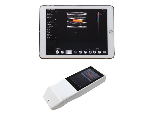 Wireless Linear Probe High Frequency Probe Special Tool for Visual Puncture Guidance Integrated Handheld Ultrasound Scanner