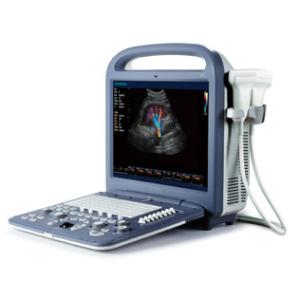 Wholesale 4D Ultrasound Equipment With 15 Inch LCD , Color Doppler Ultrasound Machine from china suppliers