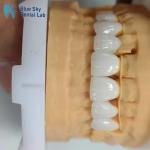 5mm-6mm Layered Zirconia Crowns Strength Zirconia Multilayer Crown