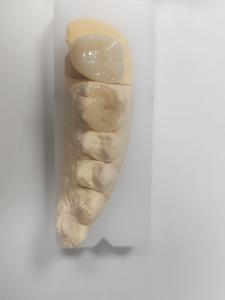 Wholesale Dental Inlay And Onlay For Indirect Filling And Tooth-Colored Restoration from china suppliers