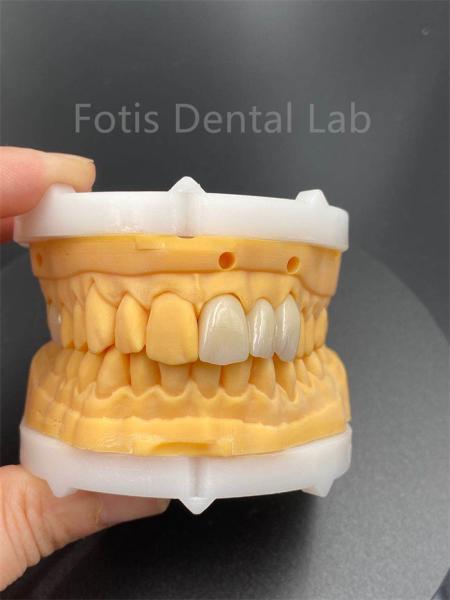 High Durability Multilayered Zirconia Dental Ceramics For Dental Lab Medical