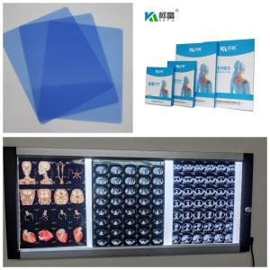 Wholesale CT DR MRI Inkjet Medical X Ray Film 3D Image Output 8x10 11x14 14X17 Inch from china suppliers