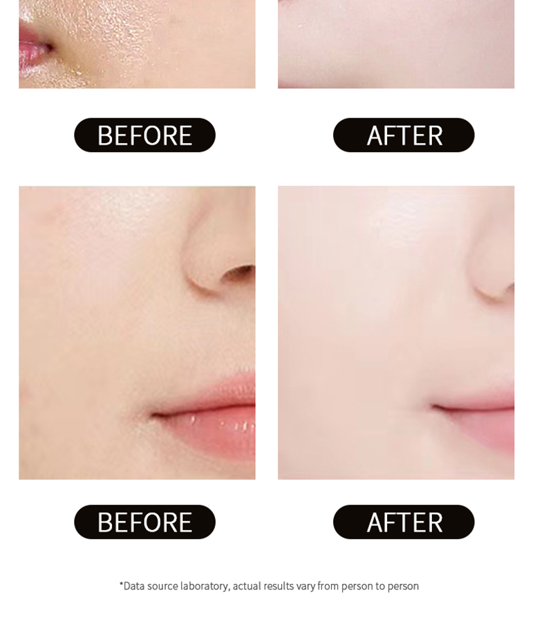 Multiple Moisturizing Ingredients Refine Pores And Make Skin Soft Whitening Face Toner For Hyperpigmentation
