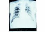 Diagnostic AGFA Digital X Ray Film Waterproof With Bright Tone