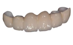 Wholesale Smooth Surface Porcelain Dental Crown Restore Chewing Power Good Stability from china suppliers