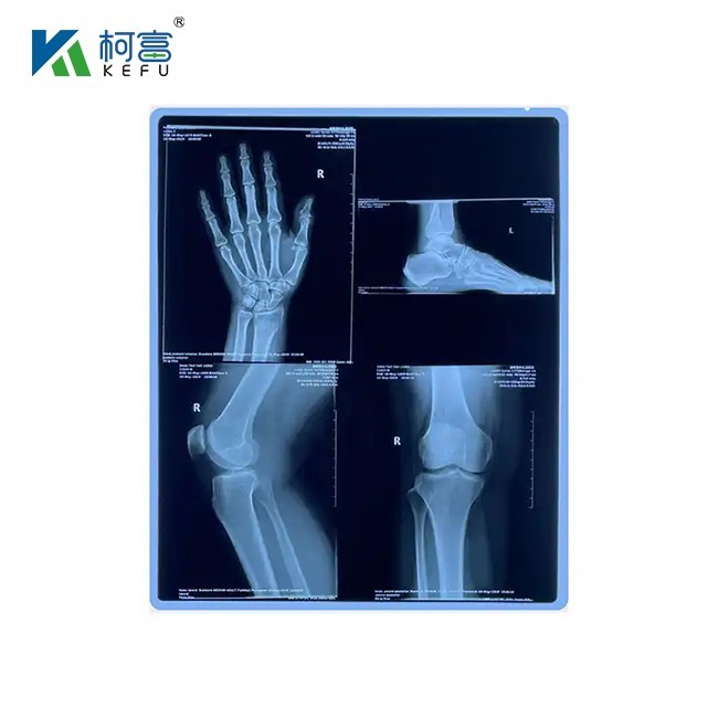 Medical X Ray Dry Film High Sharpness Protective Layer Thickness 200±5μm