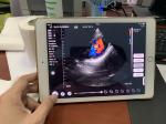 Wireless Phased Array Ultrasound Transducer Handheld Cardiac Echography Wireless