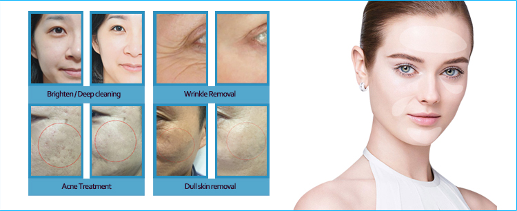 Vacuum Cleaner H2O2 Hydrogen Oxygen Machine Anti aging Pore