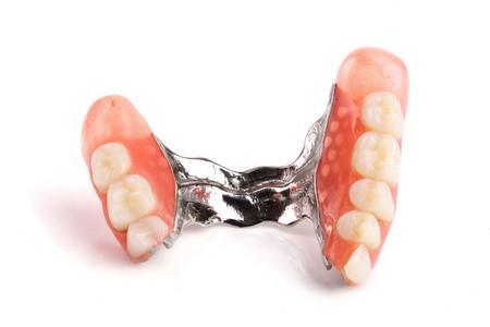 Invisible Removable Dentures Wisdom Teeth Big Teeth Restoration Implant Covering