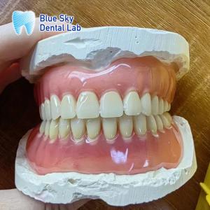 Wholesale Missing Teeth Acrylic full Denture Restoration Acrylic Complete Denture from china suppliers