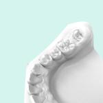 Orthodontic Model Photosensitive Resin High Temperature Resistant