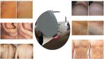 High Performance Diode Laser Hair Removal For Salon , 10.4'' Touch Color Screen