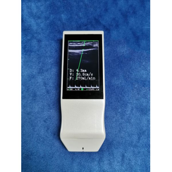 Wireless Linear Probe High Frequency Probe Special Tool for Visual Puncture Guidance Integrated Handheld Ultrasound Scanner
